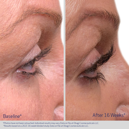 Obagi Nu-Cil wimperserum voor en na 16 weken