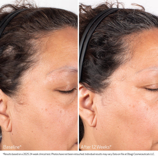 Obagi Nu-Cil BioStim voor en na